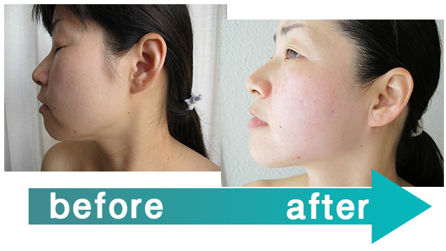 ミハナ・ビューティー&スパ